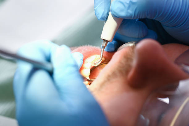 Best Emergency Treatment for Oral Infections in Guntersville, AL